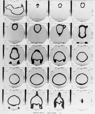 a 4 by 5 grid showing black and white images representing cross-sections of a ceramic dog.