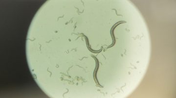 Photo of worms under a microscope