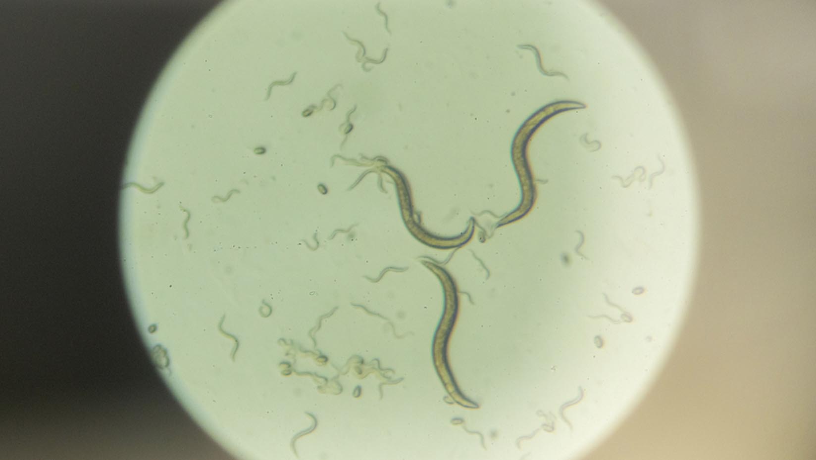 Photo of worms under a microscope