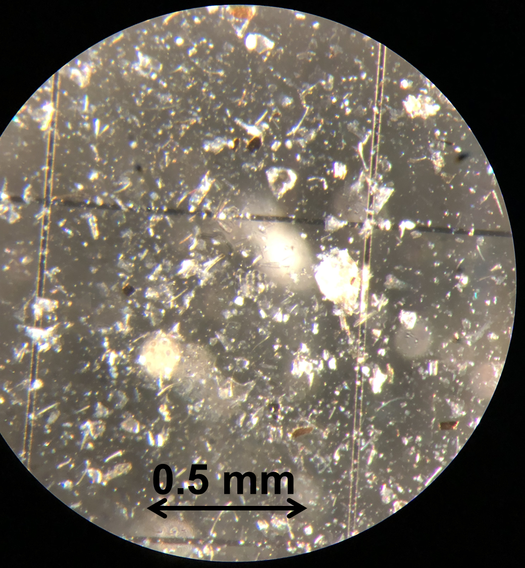 A photo of a gut of a crustacean